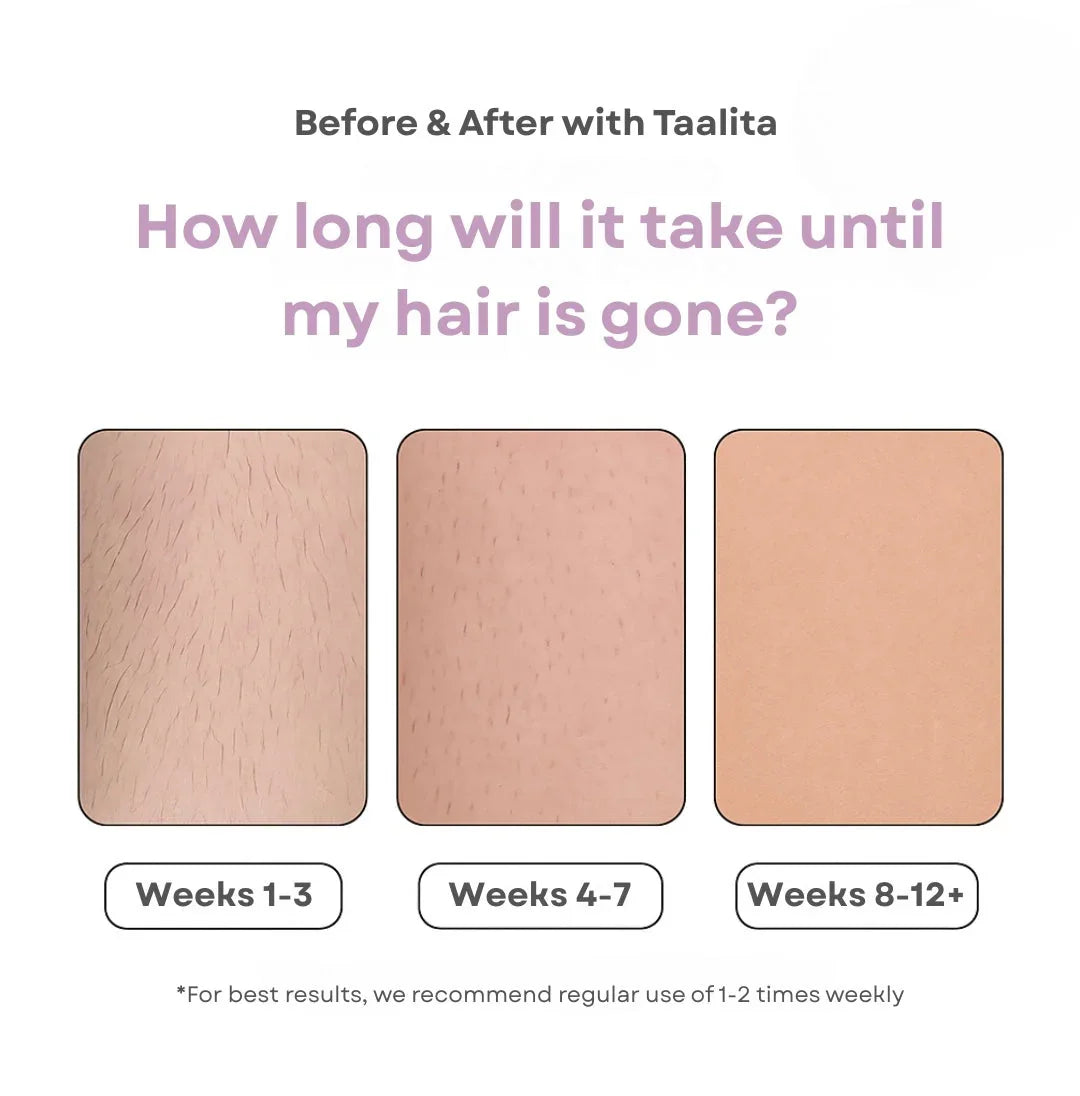 Hair removal progress showing gradual reduction from weeks 1-3 to weeks 8-12 with smoother, hair-free skin