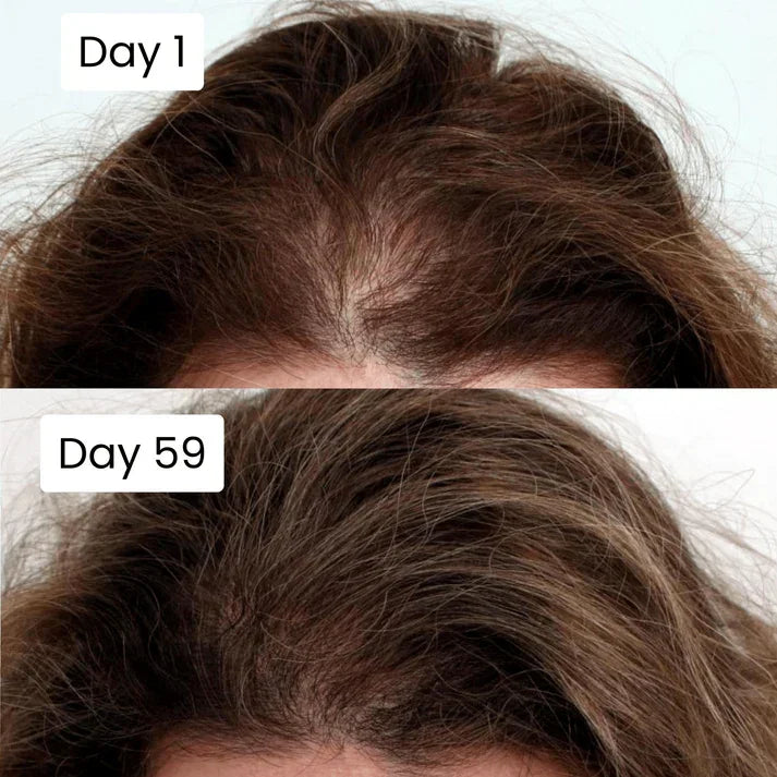 Before and after hair growth comparison showing thicker hair on day 59 versus thinner hair on day 1